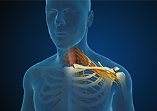 Cervical Radiculopathy & Myelopathy