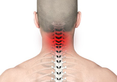 Neck Pain