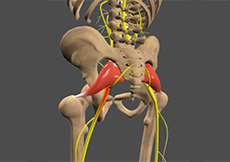 Sciatica